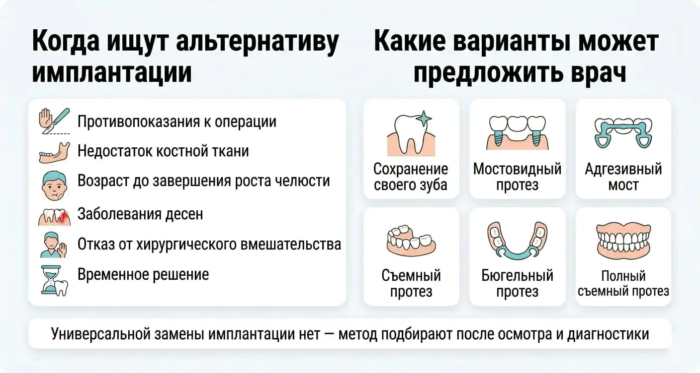 Когда нужна альтернатива имплантации зубов: основные причины и варианты восстановления зубов.