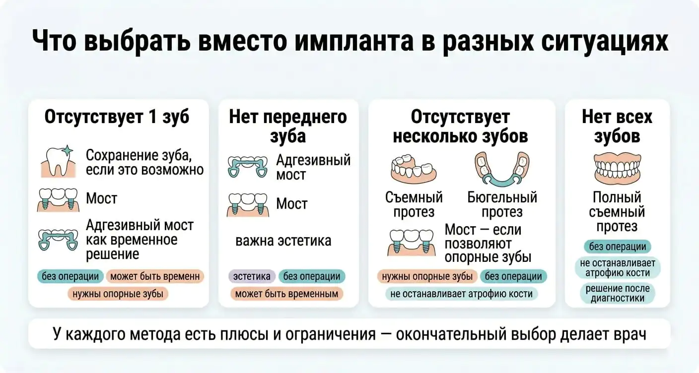 Что выбрать вместо импланта: варианты восстановления одного, нескольких или всех зубов без имплантации.