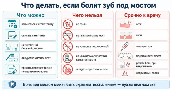 Алгоритм действий при боли под зубным мостом: что можно делать, чего нельзя и когда нужно срочно обратиться к стоматологу.