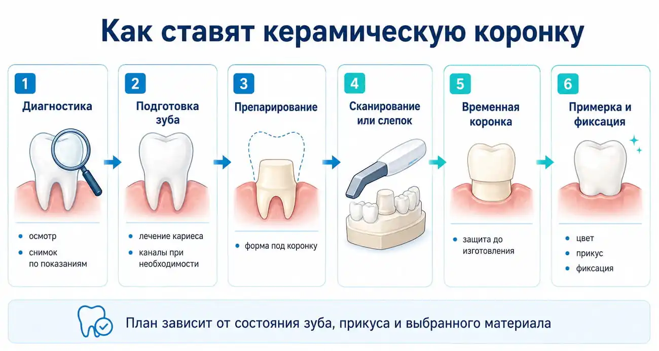 Этапы установки керамической коронки: диагностика, подготовка зуба, препарирование, слепок, временная коронка, примерка и фиксация.