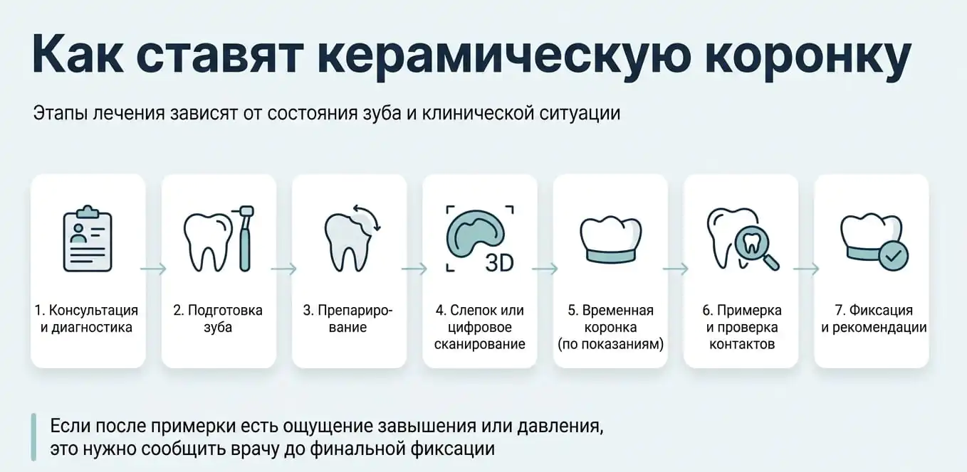 Этапы установки керамической коронки: диагностика, подготовка зуба, препарирование, слепок, временная коронка, примерка и фиксация