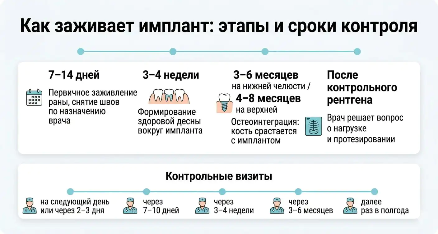 Этапы заживления импланта зуба и контрольные осмотры: от 7–14 дней до 3–8 месяцев остеоинтеграции.