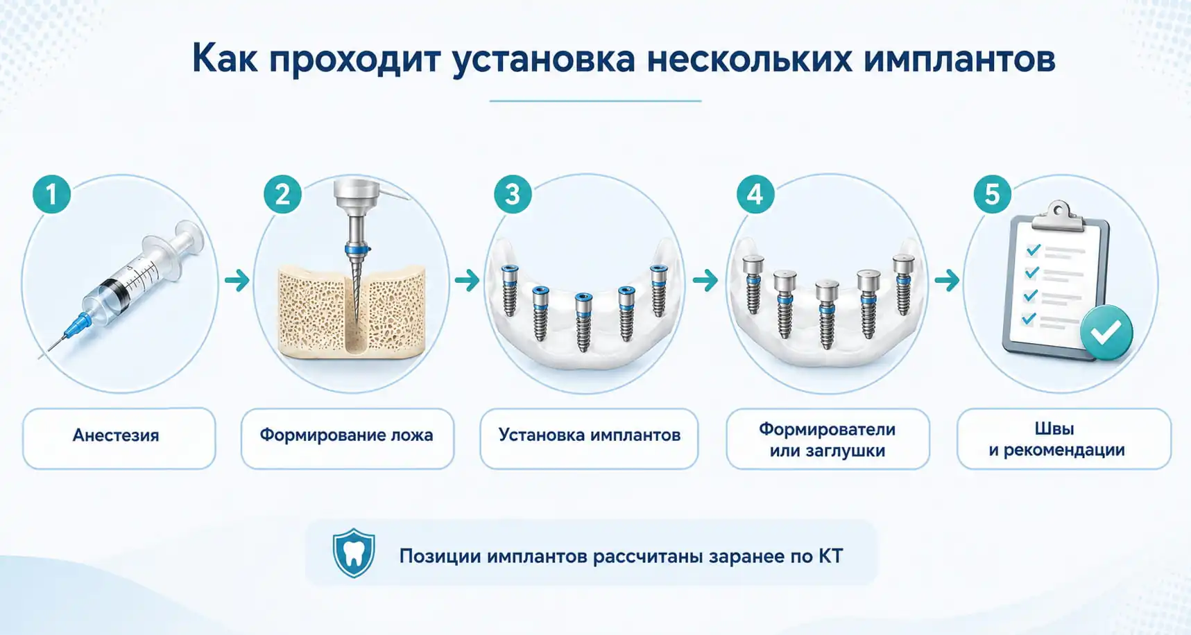Этапы установки нескольких зубных имплантов: анестезия, формирование ложа, установка, швы
